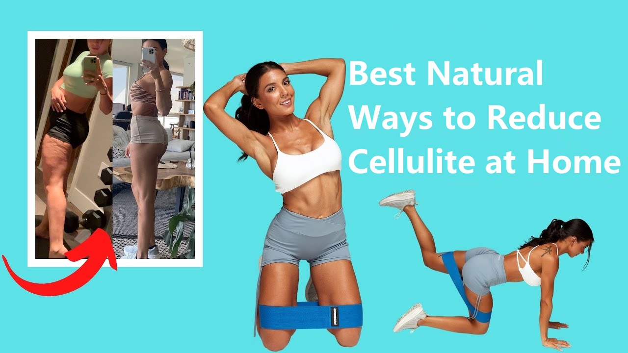 Cellulite